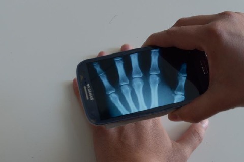 Xray Prank截圖2