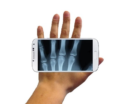 Xray Prank截圖