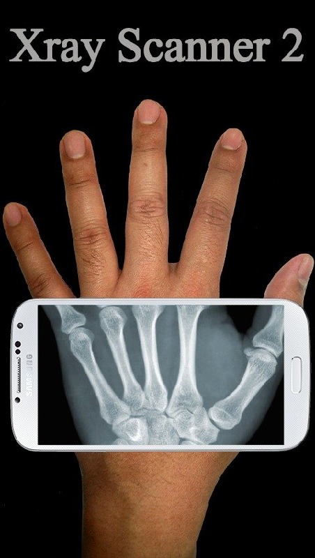 Xray Scanner Prank 2截图4